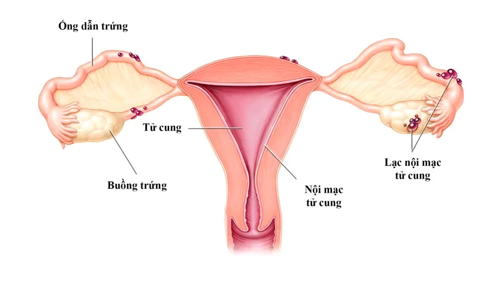 10 nguyên nhân phổ biến khiến vợ chồng khó mang thai tự nhiên