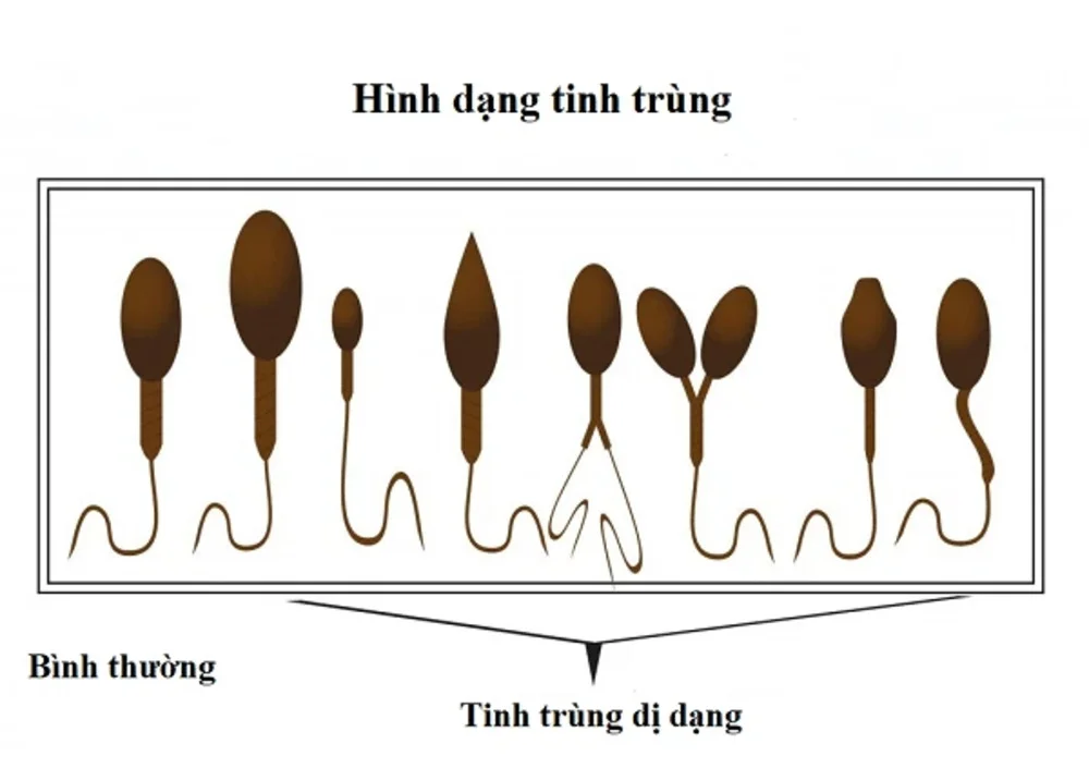 Vô sinh hiếm muộn là gì? Nguyên nhân và dấu hiệu nhận biết
