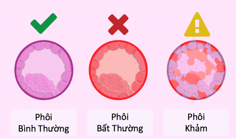 Làm thế nào để tăng khả năng giữ thai an toàn