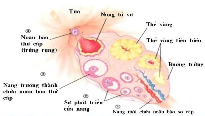 Liệu trình INC dành cho nữ: PCOS, AMH thấp, tắc vòi trứng – nên bắt đầu từ đâu?