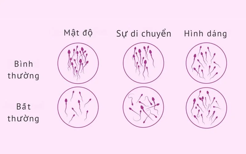 Tinh dịch đồ là gì? Tất cả những điều nam giới cần biết