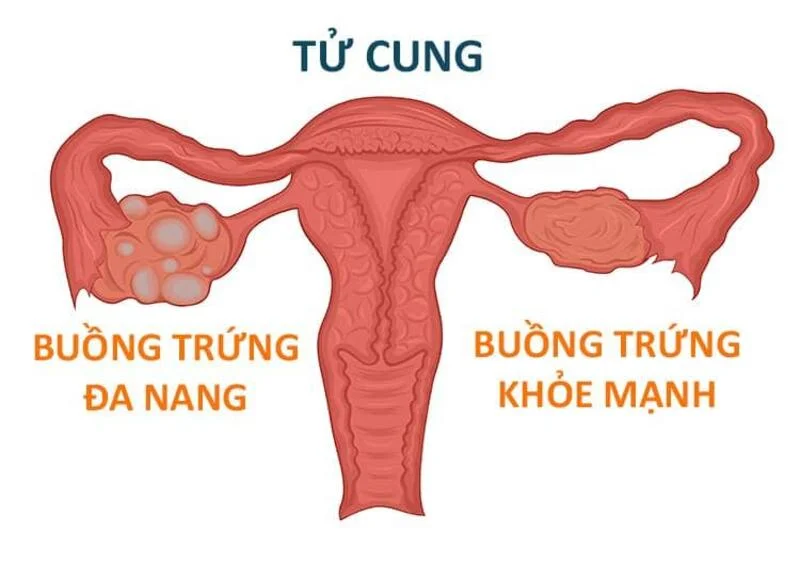 Vừa muốn có thai tự nhiên, vừa mắc bệnh lý – Phải làm sao