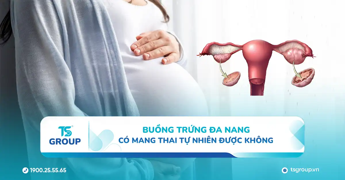 Buồng trứng đa nang có mang thai tự nhiên được không