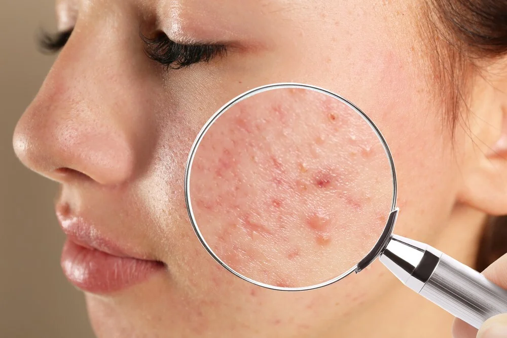Làm ca đêm lâu năm có gây rối loạn nội tiết, ảnh hưởng đến khả năng thụ thai