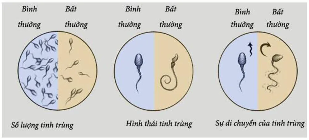 Làm việc trong khu công nghiệp ảnh hưởng thế nào đến sức khỏe sinh sản