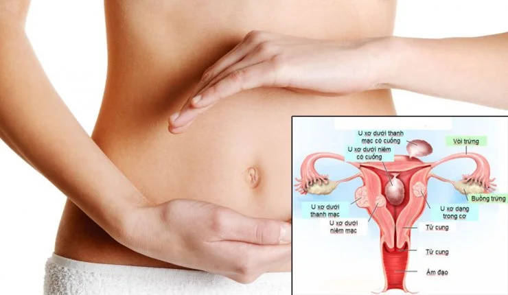 Công nhân đứng lâu, làm việc nặng có khó mang thai hơn không