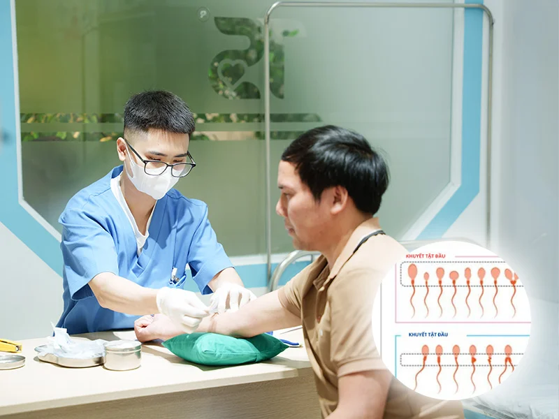 Nam giới có những dấu hiệu nào dễ liên quan đến tinh trùng yếu, khó có con?