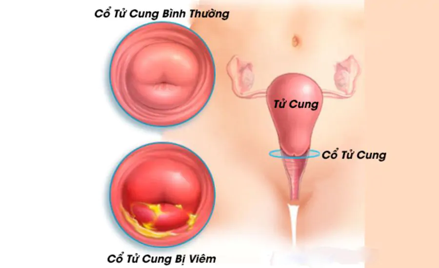 Thực trạng vô sinh hiếm muộn tại Việt Nam 2026: người trẻ cần lưu ý điều gì?